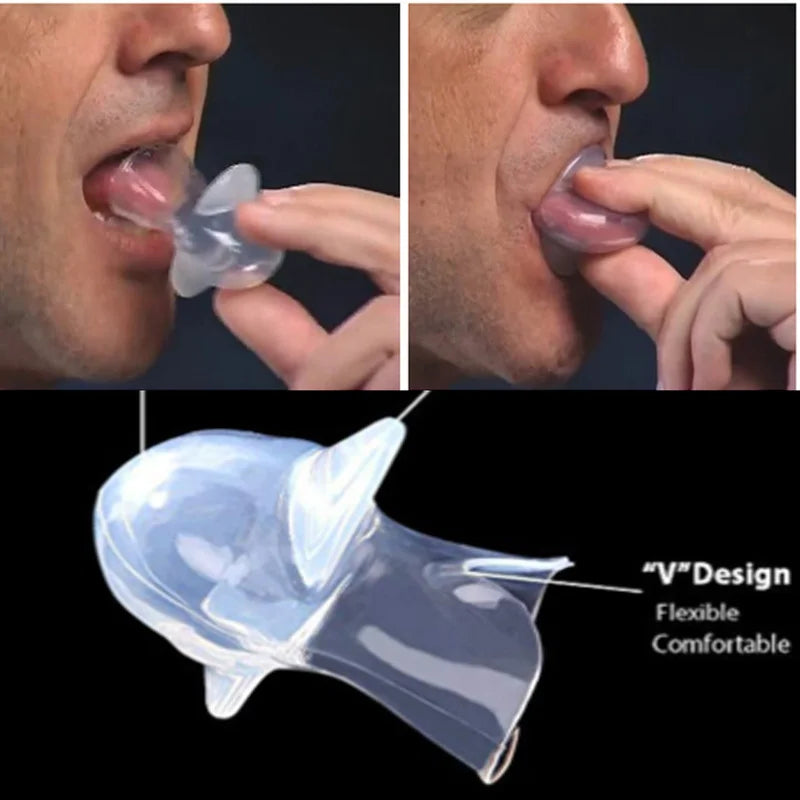 Anti Snore Mouthpiece Tongue Retainer For Sleep Apnea